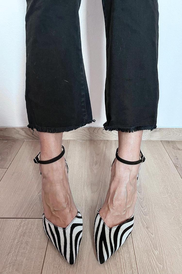 Zebra-Print Pumps with Ankle Strap – Chic, Comfortable Style